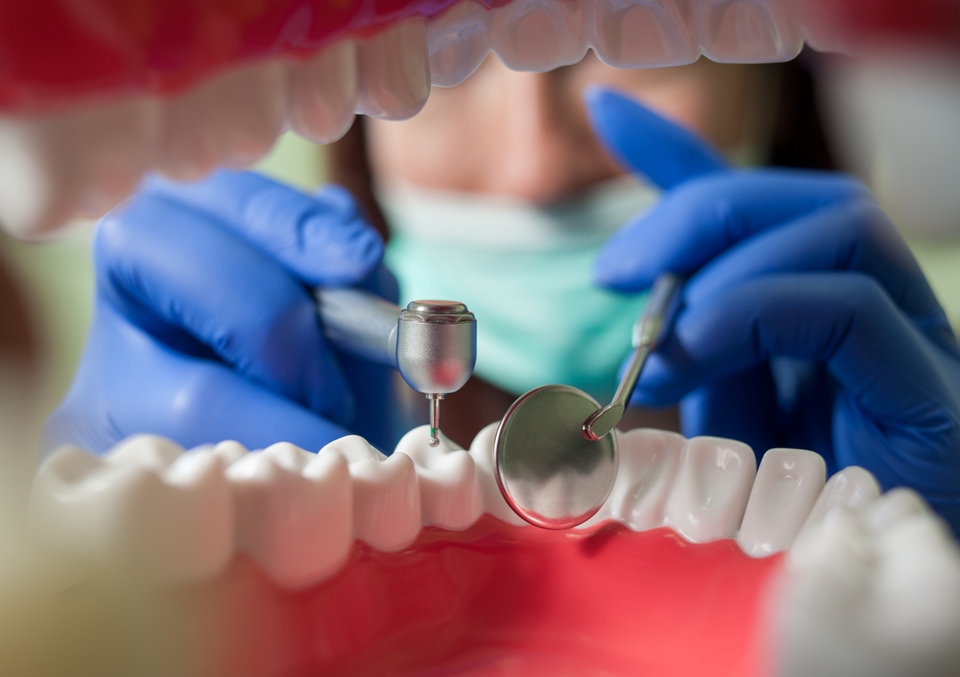 並非所有患者都適合全口重建​植牙，怎麼聽懂醫師的話術